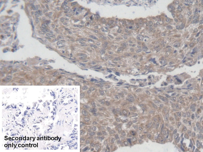 MRPL1 Antibody in Immunohistochemistry (Paraffin) (IHC (P))