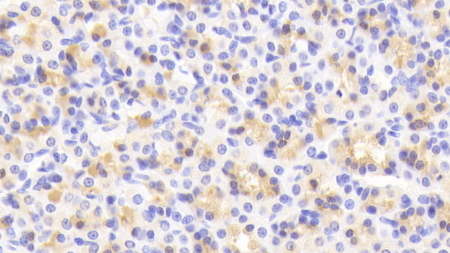 MAP3K6 Antibody in Immunohistochemistry (Paraffin) (IHC (P))