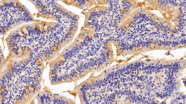 MUC2 Antibody in Immunohistochemistry (Paraffin) (IHC (P))