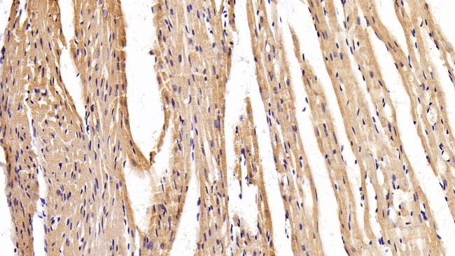 MYH2 Antibody in Immunohistochemistry (Paraffin) (IHC (P))