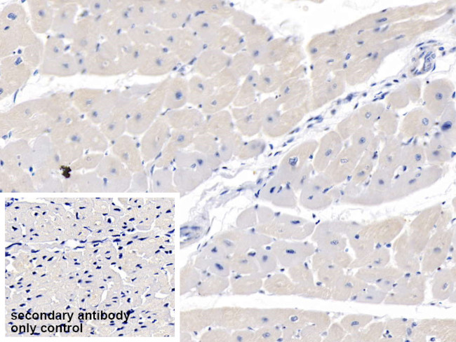 MYH7 Antibody in Immunohistochemistry (Paraffin) (IHC (P))