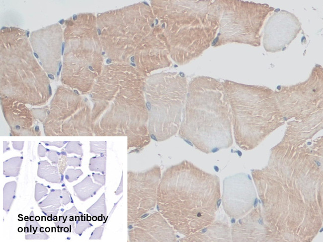 MYO1D Antibody in Immunohistochemistry (Paraffin) (IHC (P))