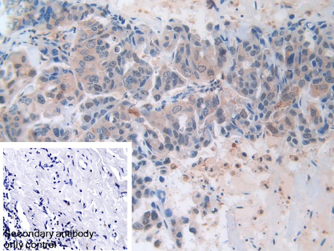 MX1 Antibody in Immunohistochemistry (Paraffin) (IHC (P))