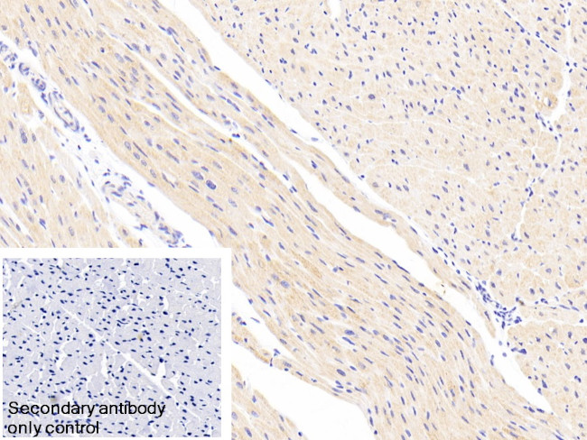 NDUFS1 Antibody in Immunohistochemistry (Paraffin) (IHC (P))