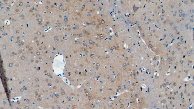 NCDN Antibody in Immunohistochemistry (Paraffin) (IHC (P))