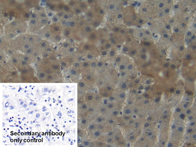 NNMT Antibody in Immunohistochemistry (Paraffin) (IHC (P))