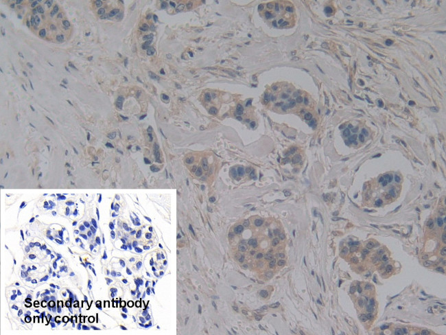 NOSIP Antibody in Immunohistochemistry (Paraffin) (IHC (P))