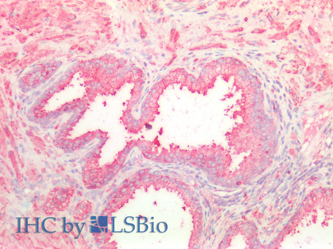 NOTCH2NL Antibody in Immunohistochemistry (Paraffin) (IHC (P))
