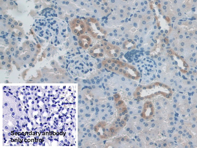 NXN Antibody in Immunohistochemistry (Paraffin) (IHC (P))