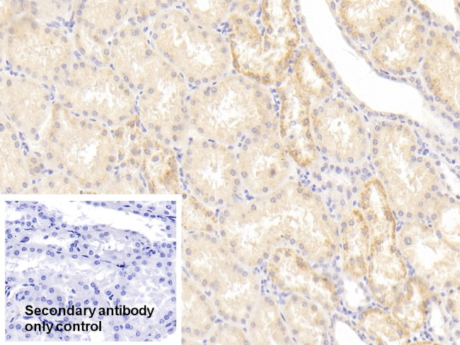 NUMB Antibody in Immunohistochemistry (Paraffin) (IHC (P))