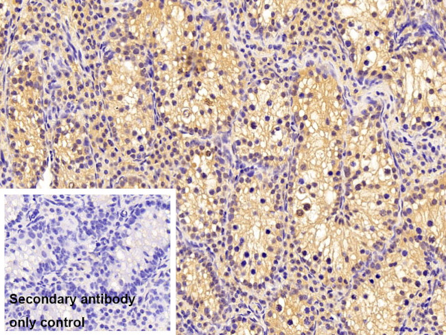 MGMT Antibody in Immunohistochemistry (Paraffin) (IHC (P))