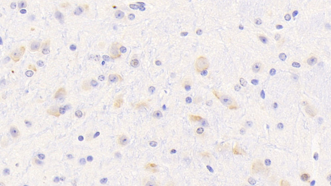OPHN1 Antibody in Immunohistochemistry (Paraffin) (IHC (P))