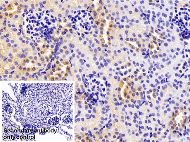 ORM2 Antibody in Immunohistochemistry (Paraffin) (IHC (P))