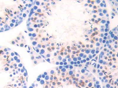 CELA1 Antibody in Immunohistochemistry (Paraffin) (IHC (P))