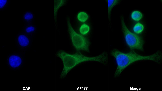PFKP Antibody in Immunocytochemistry (ICC/IF)
