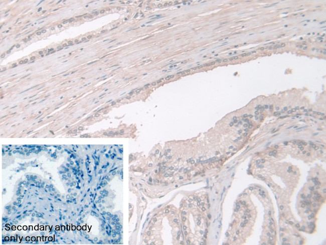 PGM1 Antibody in Immunohistochemistry (Paraffin) (IHC (P))