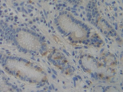 PIK3AP1 Antibody in Immunohistochemistry (Paraffin) (IHC (P))