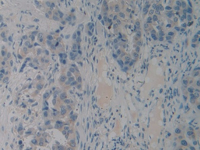 PACAP Antibody in Immunohistochemistry (Paraffin) (IHC (P))