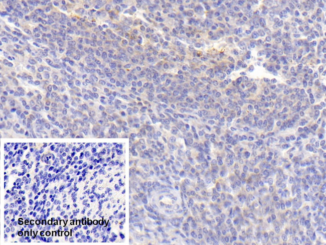 PAFAH1B3 Antibody in Immunohistochemistry (Paraffin) (IHC (P))