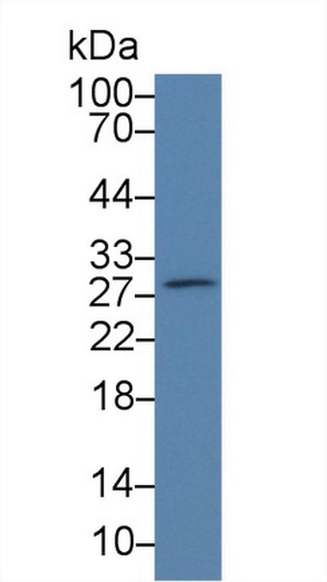 PAFAH1B3 Antibody in Western Blot (WB)