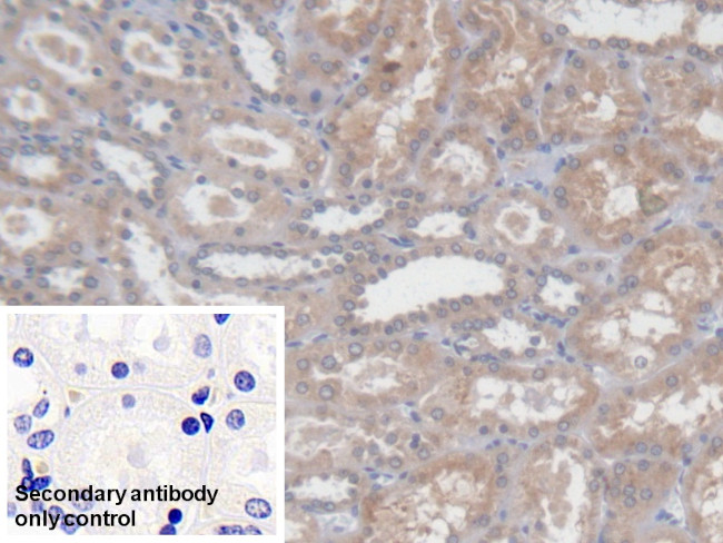 PCYOX1 Antibody in Immunohistochemistry (Paraffin) (IHC (P))