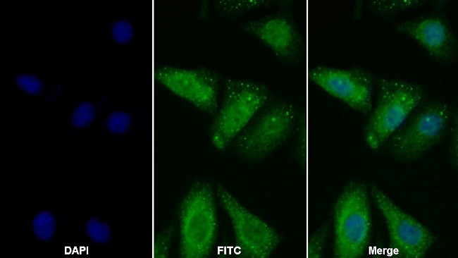 PD-L1 Antibody in Immunocytochemistry (ICC/IF)