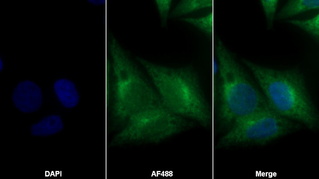 Prohibitin Antibody in Immunocytochemistry (ICC/IF)