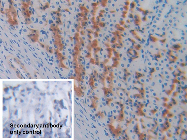 GCDFP-15 Antibody in Immunohistochemistry (Paraffin) (IHC (P))