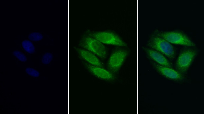 PSAP Antibody in Immunocytochemistry (ICC/IF)
