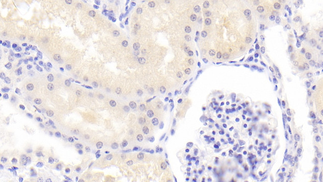 PSMD6 Antibody in Immunohistochemistry (Paraffin) (IHC (P))