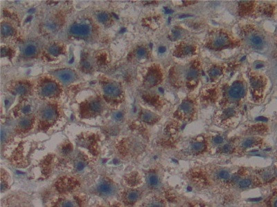 PSMD9 Antibody in Immunohistochemistry (Paraffin) (IHC (P))