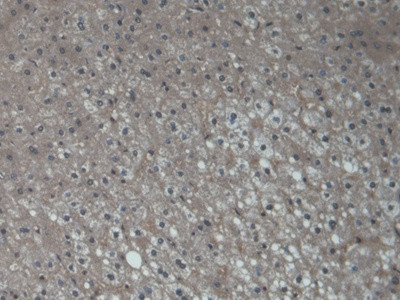 POMP Antibody in Immunohistochemistry (Paraffin) (IHC (P))
