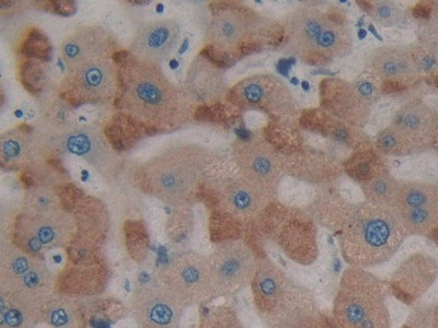 PTPRH Antibody in Immunohistochemistry (Paraffin) (IHC (P))