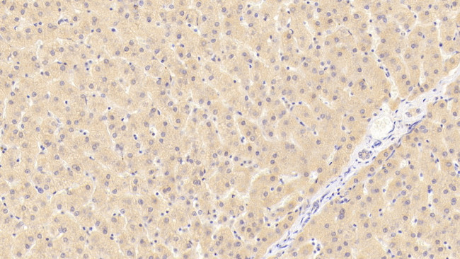 PTPRH Antibody in Immunohistochemistry (Paraffin) (IHC (P))