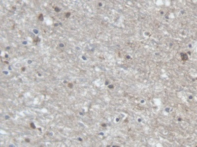 PCDHA1 Antibody in Immunohistochemistry (Paraffin) (IHC (P))