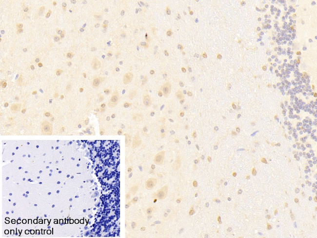PCDHA1 Antibody in Immunohistochemistry (Paraffin) (IHC (P))