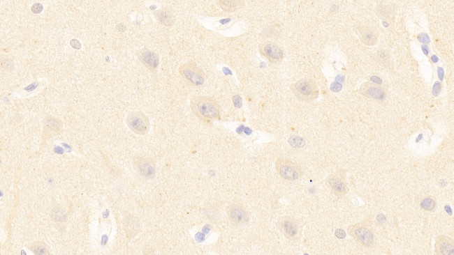 PCDHB15 Antibody in Immunohistochemistry (Paraffin) (IHC (P))