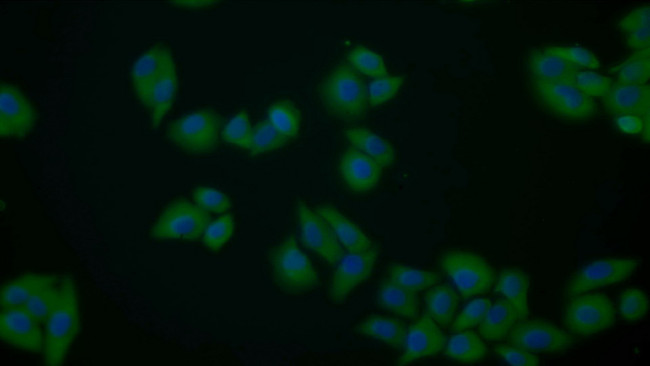 PKM2 Antibody in Immunocytochemistry (ICC/IF)
