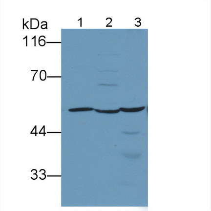 RORA Antibody in Western Blot (WB)