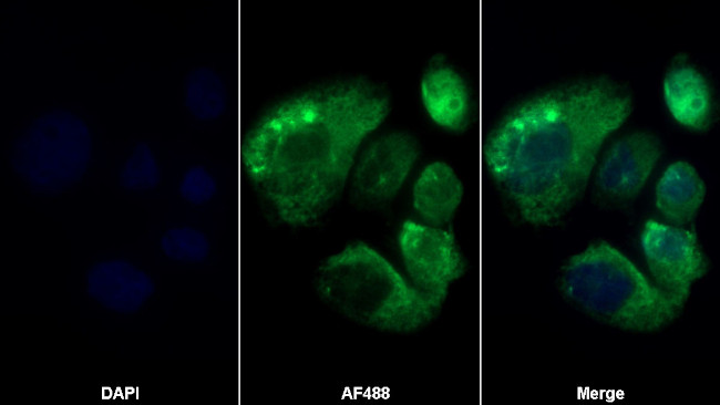 RANK (CD265) Antibody in Immunocytochemistry (ICC/IF)