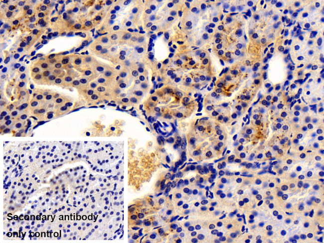 RBP4 Antibody in Immunohistochemistry (Paraffin) (IHC (P))