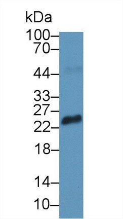 RS1 Antibody in Western Blot (WB)