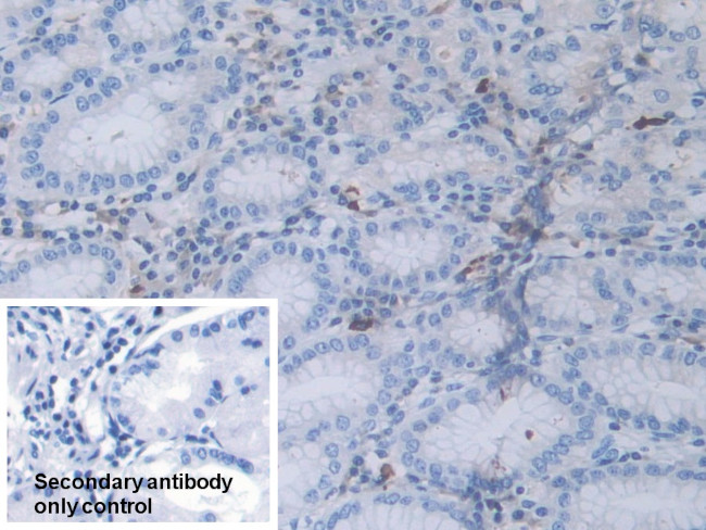 RNaseL Antibody in Immunohistochemistry (Paraffin) (IHC (P))