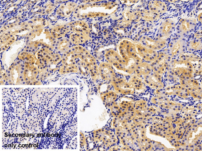 SCRN1 Antibody in Immunohistochemistry (Paraffin) (IHC (P))
