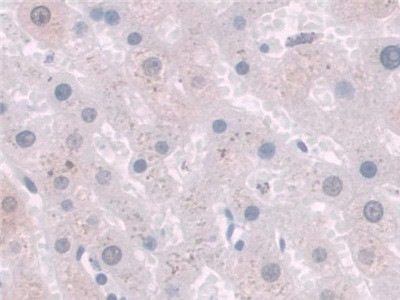 HAI-2 Antibody in Immunohistochemistry (Paraffin) (IHC (P))