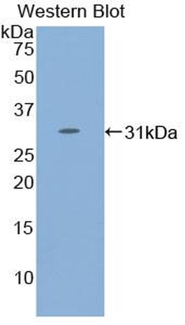 STAT4 Antibody in Western Blot (WB)