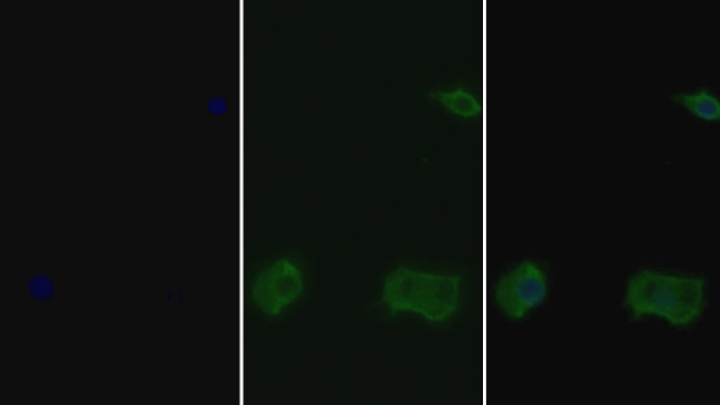 STAT5 beta Antibody in Immunocytochemistry (ICC/IF)