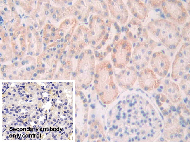SLIT1 Antibody in Immunohistochemistry (Paraffin) (IHC (P))
