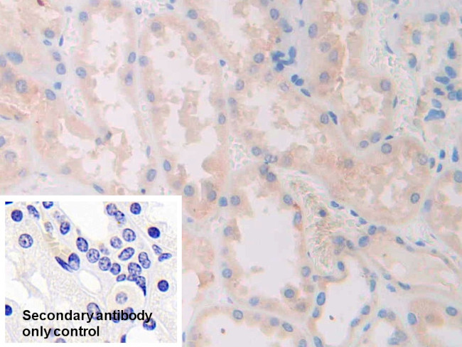 SLIT1 Antibody in Immunohistochemistry (Paraffin) (IHC (P))