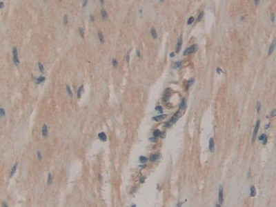 CD298 Antibody in Immunohistochemistry (Paraffin) (IHC (P))